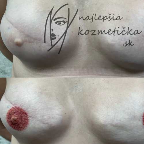 areola2.jpg